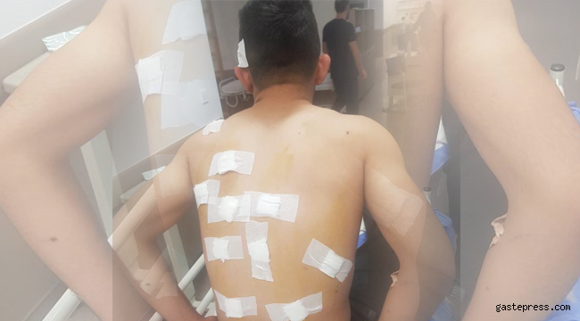 Kaybolan koyununu ararken avcıların hedefi oldu