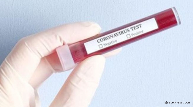 Türkiye’de bugüne kadar kaç kişiye koronavirüs testi yapıldığı belli oldu?