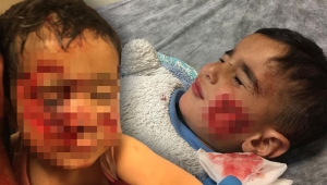 Viranşehir'de köpek saldırısına uğrayan küçük Davut, kurtarılamadı