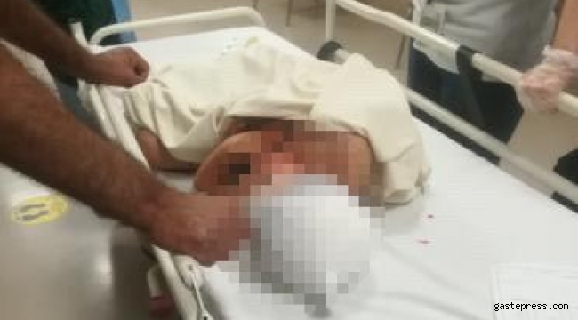 Kayseri'de yırtıcı hayvanın saldırdığı çocuk yaralandı