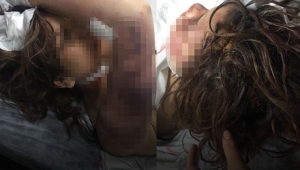 Dini nikahlı eşini zincirle dövüp, tırnaklarını çekerek işkence yaptı!