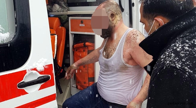 Kayseri'de ailesiyle tartışan kepçe operatörü, kendini yaktı!