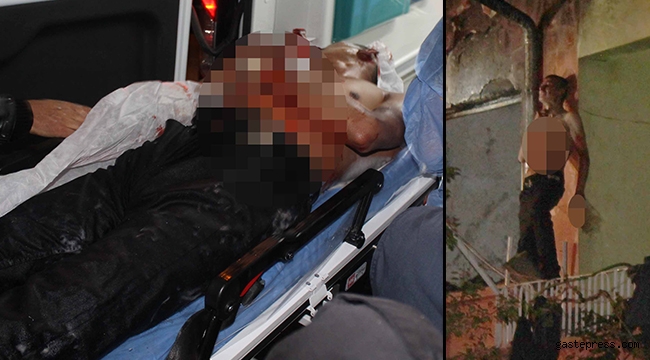 Evini ateşe verip, kendini cam parçaları ile yaraladı!