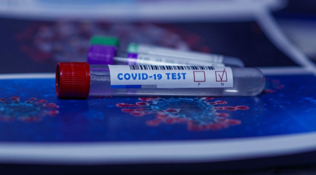 hızlı Kovid-19 testinin iç mekanlarda etkinliğini kanıtladı!