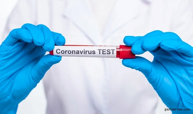 PCR testi kimler için zorunlu oluyor?
