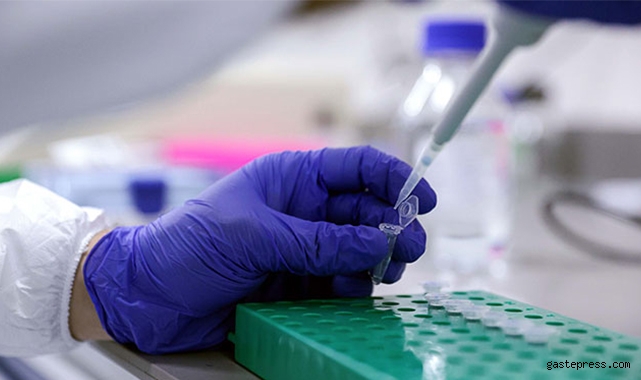 Aşı olmayan işçiden haftada bir PCR testi istenecek!