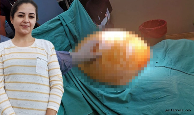 Tümör alınınca 91 kilodan 70 kiloya düştü!