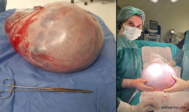 Karnından 9 kilo tümör çıktı!