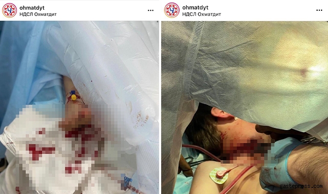 Ukrayna Büyükelçiliği, savaş mağduru ağır yaralı çocuğun fotoğraflarını paylaştı!