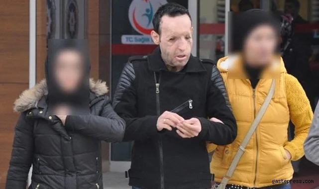 Yüz nakli yapılan Recep Sert gözaltına alındı!