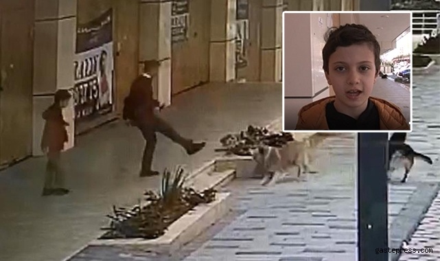 Avcılar'da köpek saldırısını yaşayan çocuk dehşet anlarını anlattı!