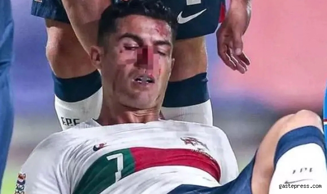 Cristiano Ronaldo kaleciyle çarpıştı kanlar içinde kaldı!