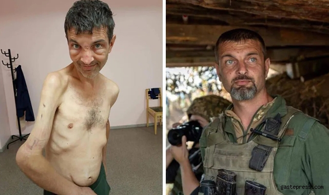 Esir takasıyla Rusların elinden kurtulan Ukraynalı askerin son hali kan dondurdu!