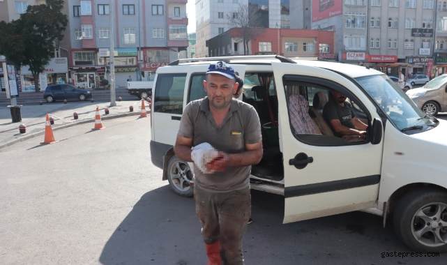 Kayseri’de 480 acemi kasap hastaneye başvurdu!