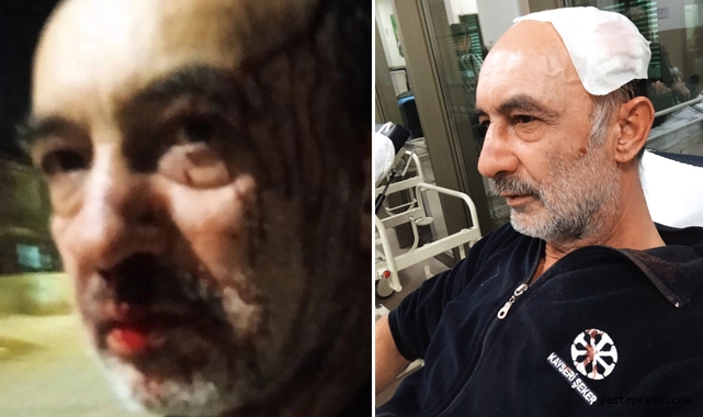 CHP'li  Badal'a Sarıoğlan'da Saldırı!