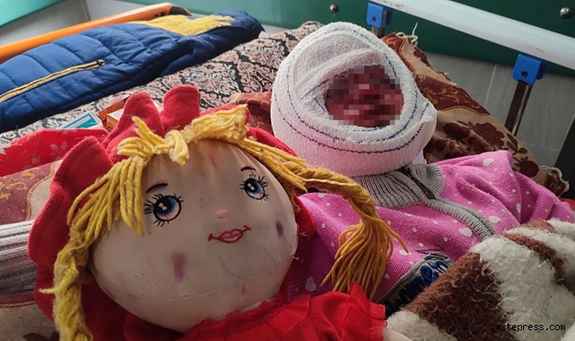 İsrail’in saldırılarında yüzü yanan 4 yaşındaki Seca, tedavi için bekliyor!