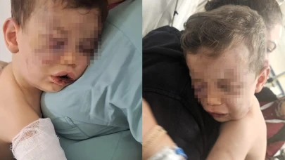 Vahşeti yaşayan 2 yaşındaki bebek hastanelik oldu!