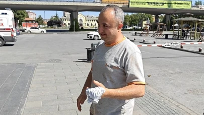 Kayseri'de 420 acemi kasap hastanelere başvurdu!