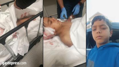 Ankara’da Sokak Köpeği Dehşeti: 8 Yaşındaki Çocuk Yaralandı!