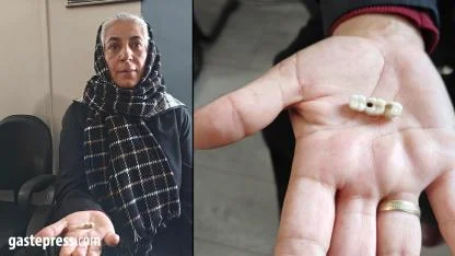 İmplant Tedavisi Kabusa Döndü: Hasta Şikâyetçi!