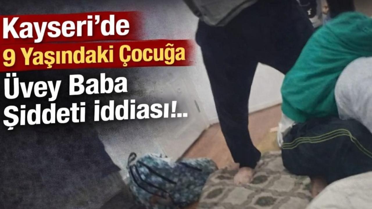 Kayseri’de 9 Yaşındaki Çocuğa Üvey Baba Şiddeti İddiası!