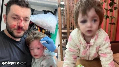 Yalova'da komşuların gürültü kavgasında 14 aylık bebek hastanelik oldu!