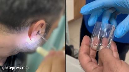 Kayseri’de Şaşırtan Olay: Uyuşturucuyu Kulağında Saklayan Şüpheli Yakalandı!