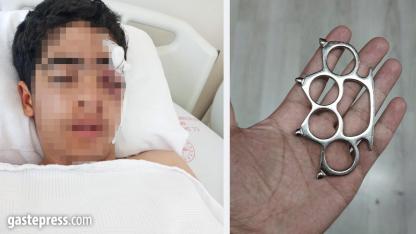 Akran zorbalığına bir yenisi eklendi: 15 yaşındaki çocuk muştayla öldüresiye dövüldü!