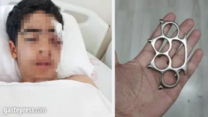 Akran zorbalığına bir yenisi eklendi: 15 yaşındaki çocuk muştayla öldüresiye dövüldü!