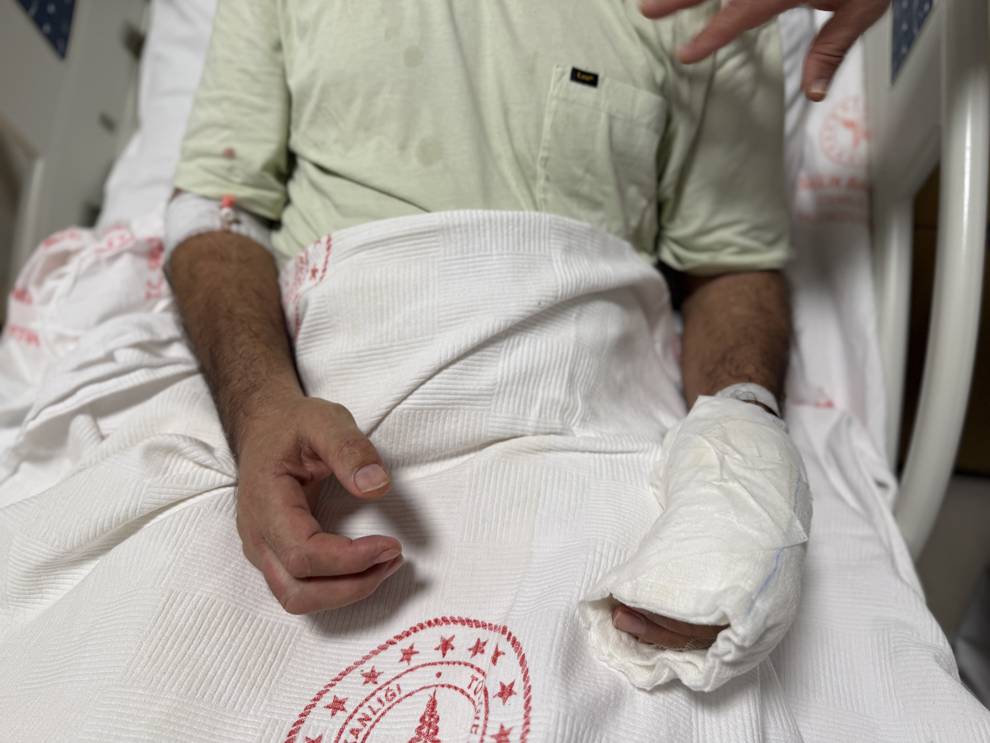 Sıcak torbası patlamasıyla vücudunun yüzde 30’u yandı: 